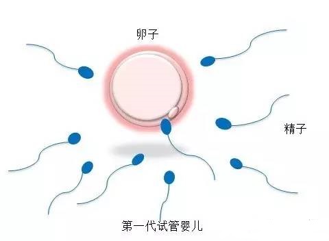 关于 专业同志代怀助孕报价多少
